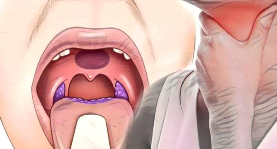 Faranjitin Bitkisel Tedavisi, Doğal Çözümü