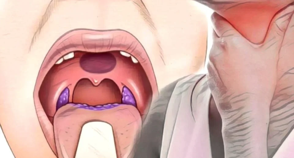 Faranjitin Bitkisel Tedavisi, Doğal Çözümü