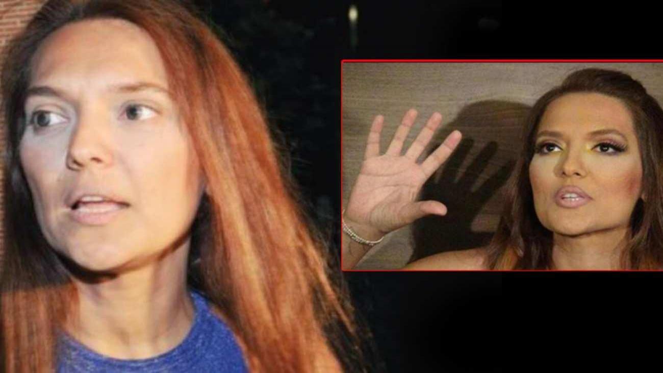 Demet Akalın tacize uğradığı anları görüntüledi! Sert sözlerde bulunan müzikçi…